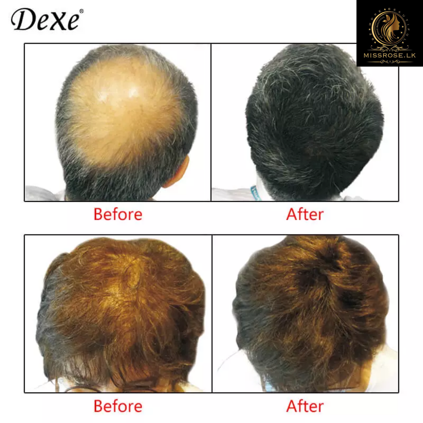 Hair Building Fibers - Missrose.lk