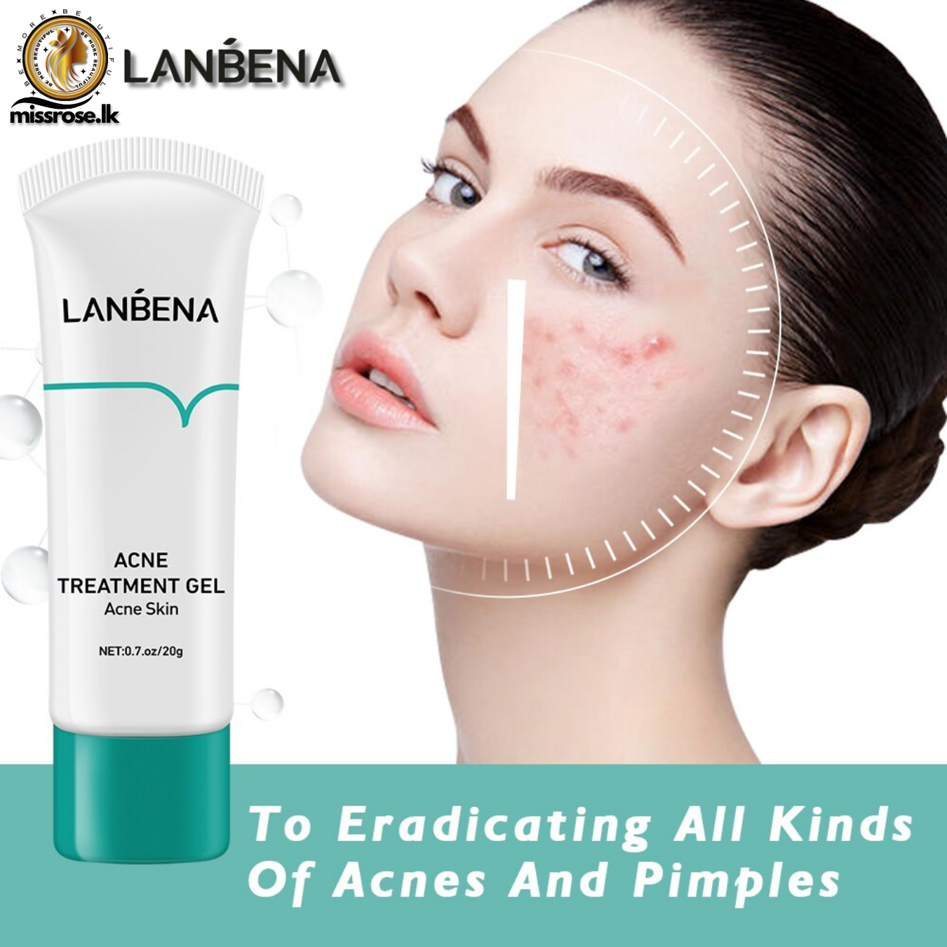 Lanbena Acne Treatment Gel 20g