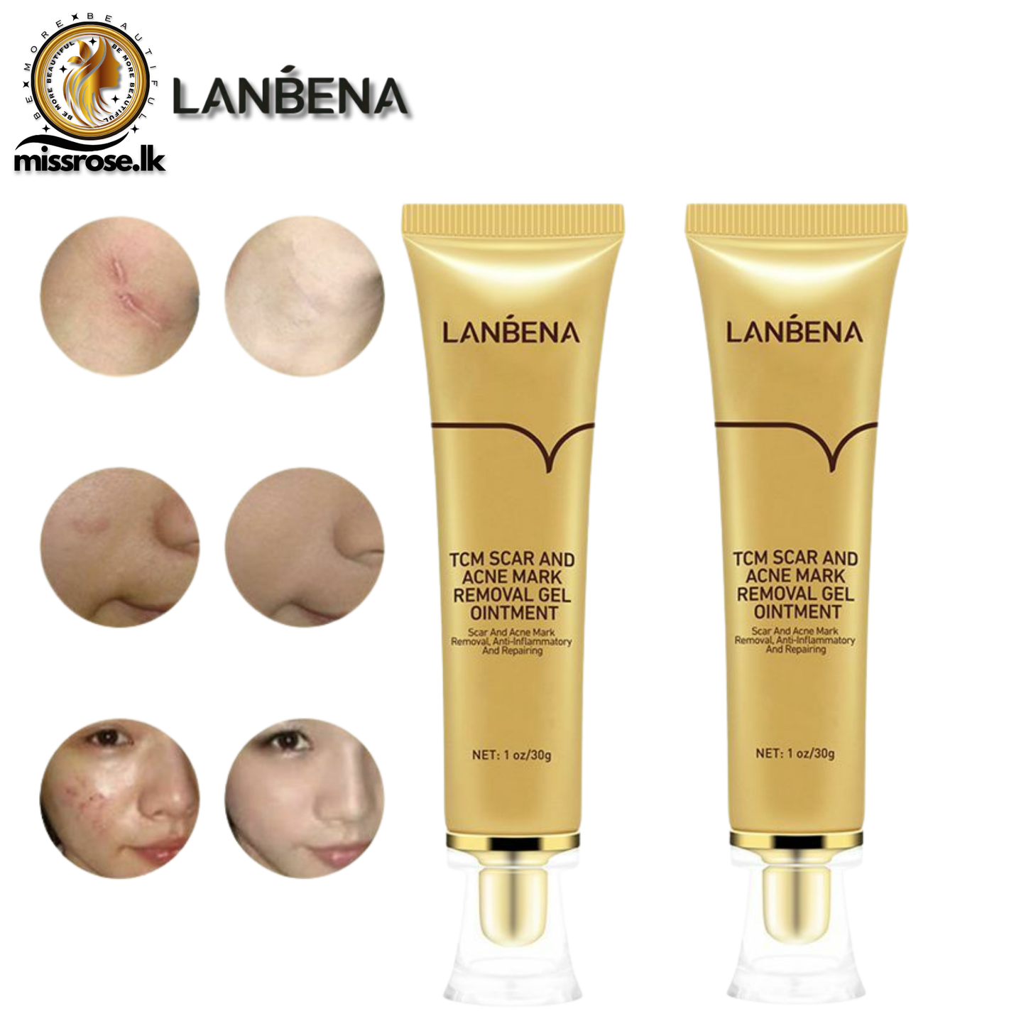 LANBENA TCM Scar And Acne Mark Removal Gel Ointment 30g